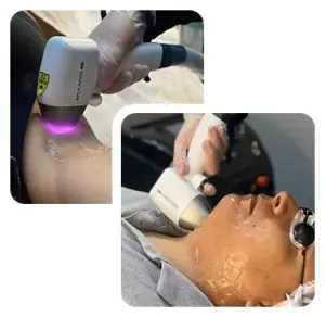 Sessão de depilação a laser na Clínica Vanitá