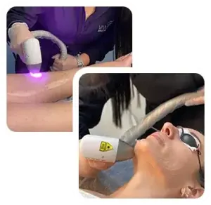 Sessão de depilação a laser na Clínica Vanitá
